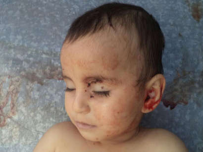 عکس: محکومیت جهانی قتل کودک آذربایجانی زیر رگبار نیروهای ارمنی / ارمنستان